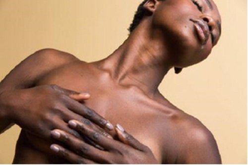 Um passo para a cura do c&acirc;ncer de mama? N&atilde;o para todos (Editorial)